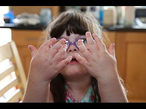 Juvenile Arthritis Types, Causes, Symptoms, Diagnosis & Treatment