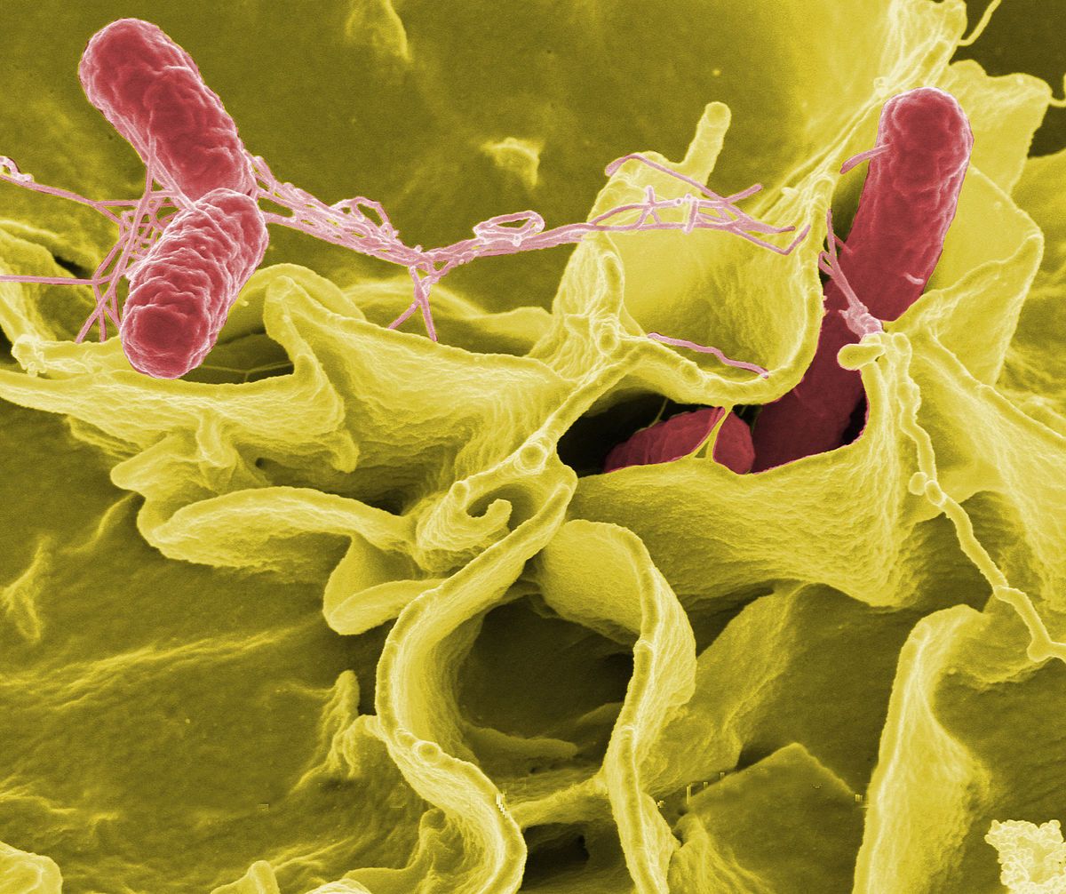 Salmonellosis (Salmonella Infection) Causes, Symptoms, Diagnosis & Treatment