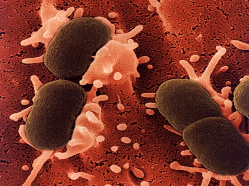 E. Coli (Escherichia Coli) Infection Causes, Symptoms, Diagnosis & Treatment