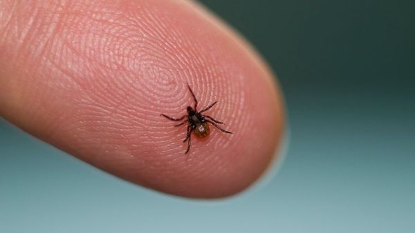 Lyme Disease: Symptoms, Prevention, Diagnosis & Treatment