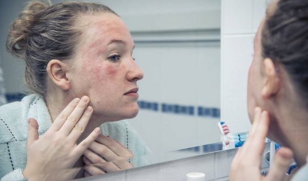 Anaphylactic Shock: Symptoms, Common Triggers, Preventions & Treatment