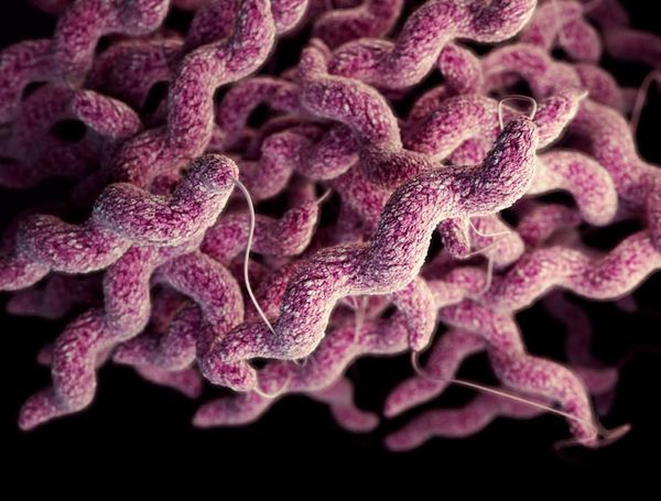 Campylobacteriosis Causes, Symptoms, Diagnosis & Treatment